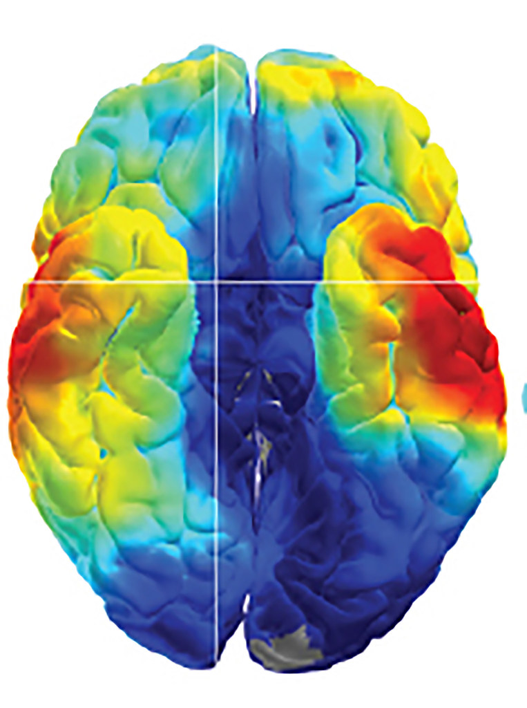 "Cracking the brain's memory codes" by National Institutes of Health (NIH) is marked with CC PDM 1.0